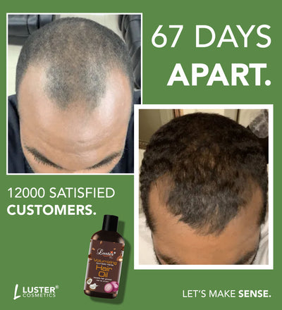 Luster Volumizing Ayurvedic Herbs Hair Oil - 210ml